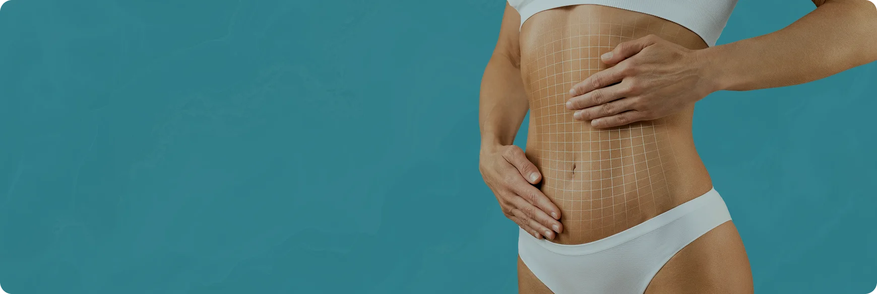 Fleur De Lis Abdominoplasty